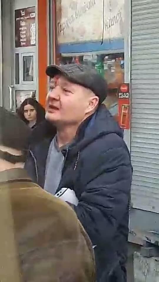 В Киеве в маршрутке мужчина разбил девушке нос из-за замечания